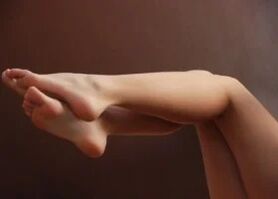 A woman's legs do not have varicose veins